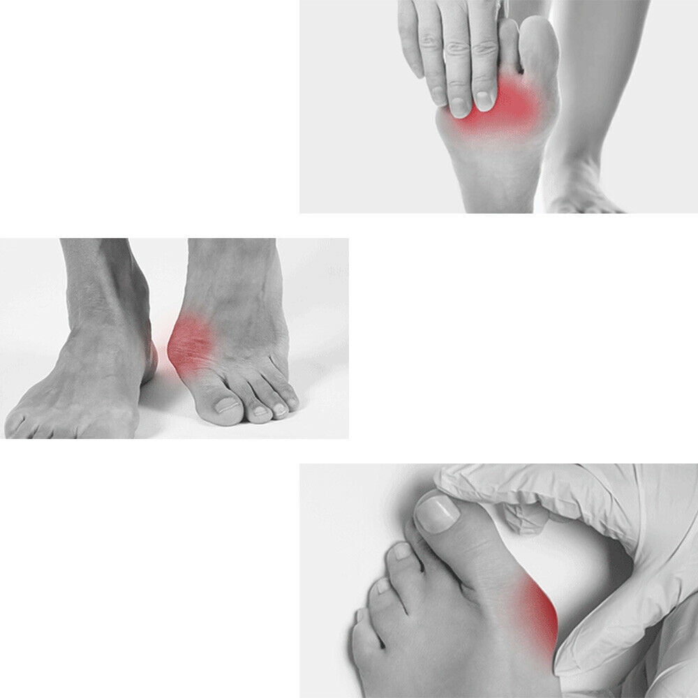 Silicone Gel Toe Separator Orthotics Bunion Toes Spacer Pain Reliever 12Pcs