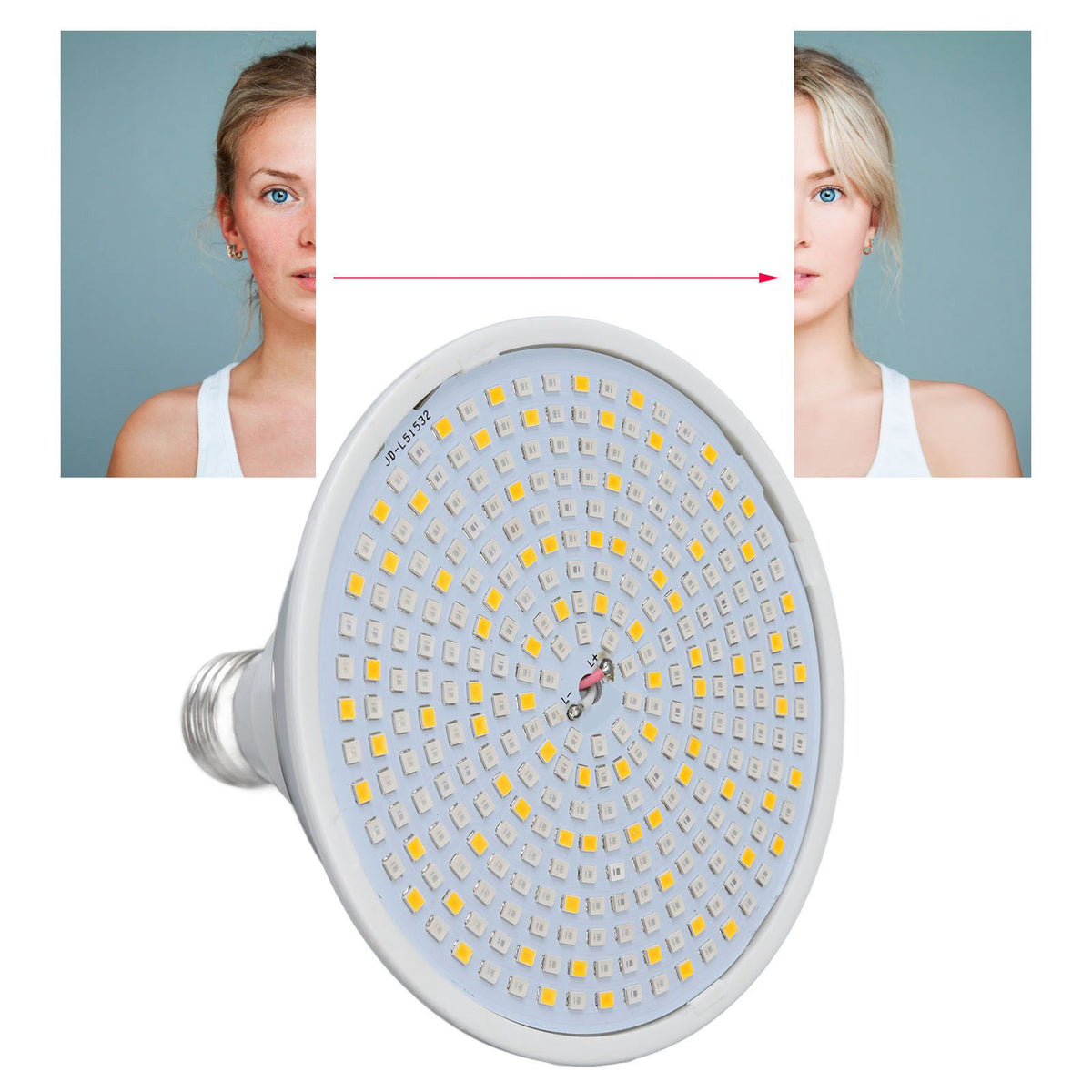 290LEDs Skin Care Therapy Light E26 E27 Facial Phototherapy Lamp Skin Firmness for Home Beauty Salon 110‑240V
