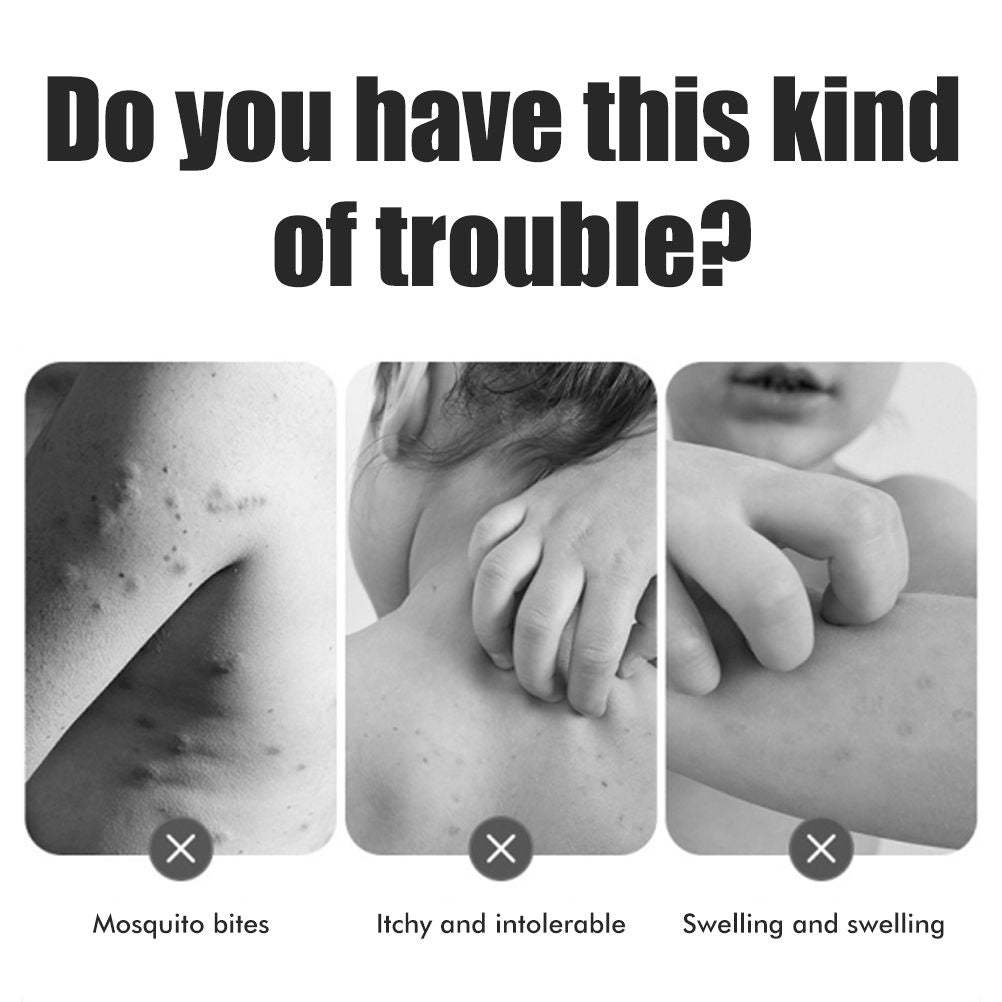 Bug Bite Itch Relief Tool USB Rechargeable Mosquito Bite Sucker Chemical Free for Bug Bites Bee Wasp Stings