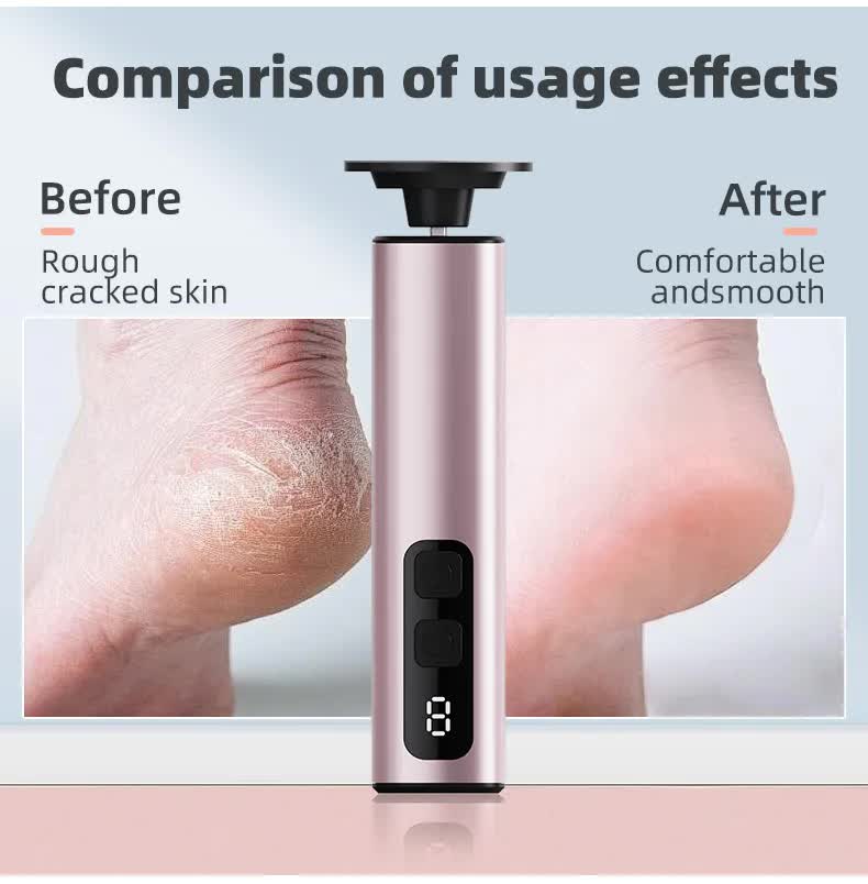 Purple Rechargeable Electric Foot File with 9 Speed Settings - Callus Remover for Smooth Feet