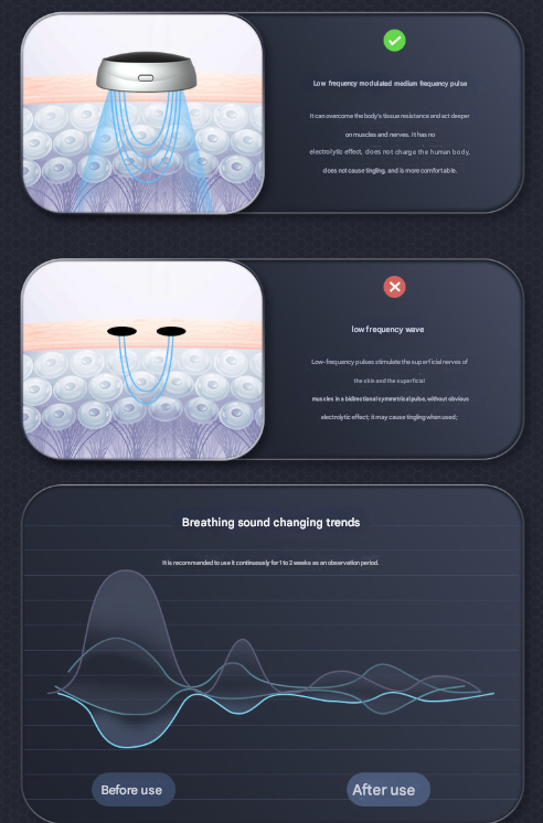 Black Smart Anti-Snoring Device - Rechargeable Pulse Throat Stimulator for Quieter Sleep