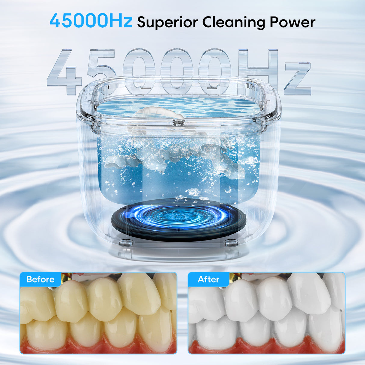 Professional Ultrasonic Cleaner with UV Light - 45000Hz for Dentures, Retainers, Jewelry & More(black)