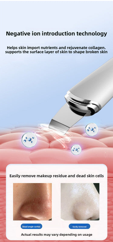 Ultrasonic Skin Scrubber Facial Spatula Blackhead Remover & Pore Cleaner with Ion EMS Lifting Mode Rechargeable Beauty Tool Pink