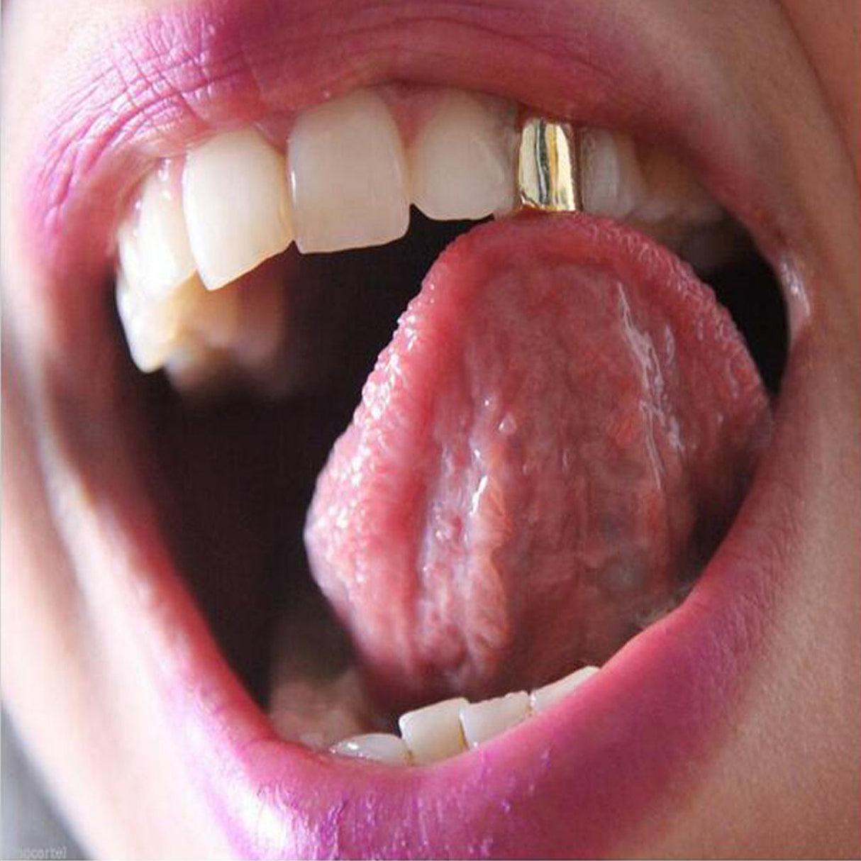 Hiphop Gold Tooth Jewelry Compatible with A$AP