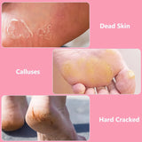 Foot File Callus Remover, Stainless Steel Pedicure Scrubber for Hard Cracked Dead Skin, Wet and Dry Foot Care, Pink - Side View