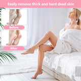 Foot File Callus Remover, Stainless Steel Pedicure Scrubber for Hard Cracked Dead Skin, Wet and Dry Foot Care, Pink