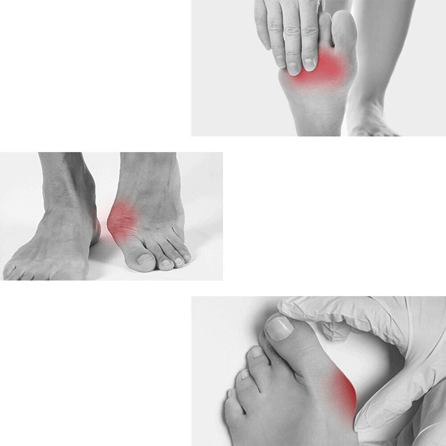 Silicone Gel Toe Separator Orthotics Bunion Toes Spacer Pain Reliever 12Pcs