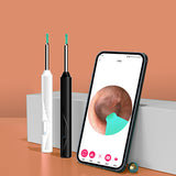 ST 1080P Wireless Ear Cleaning Otoscope Ear Cleaning Tool Black 8 PCS Set - Top-Down View