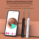 ST 1080P Wireless Ear Cleaning Otoscope Ear Cleaning Tool Black 8 PCS Set - Low Angle