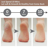 Pedicure Foot File Hard Skin Remover - Large Foot Rasp Colossal Foot Scrub Professional Stainless Steel Hard File for Wet and Dry Feet - 45-Degree Angle