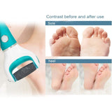 [9-pack] Scholl Velvet Smooth Pedi Replacement Rollers - yux - Rear View