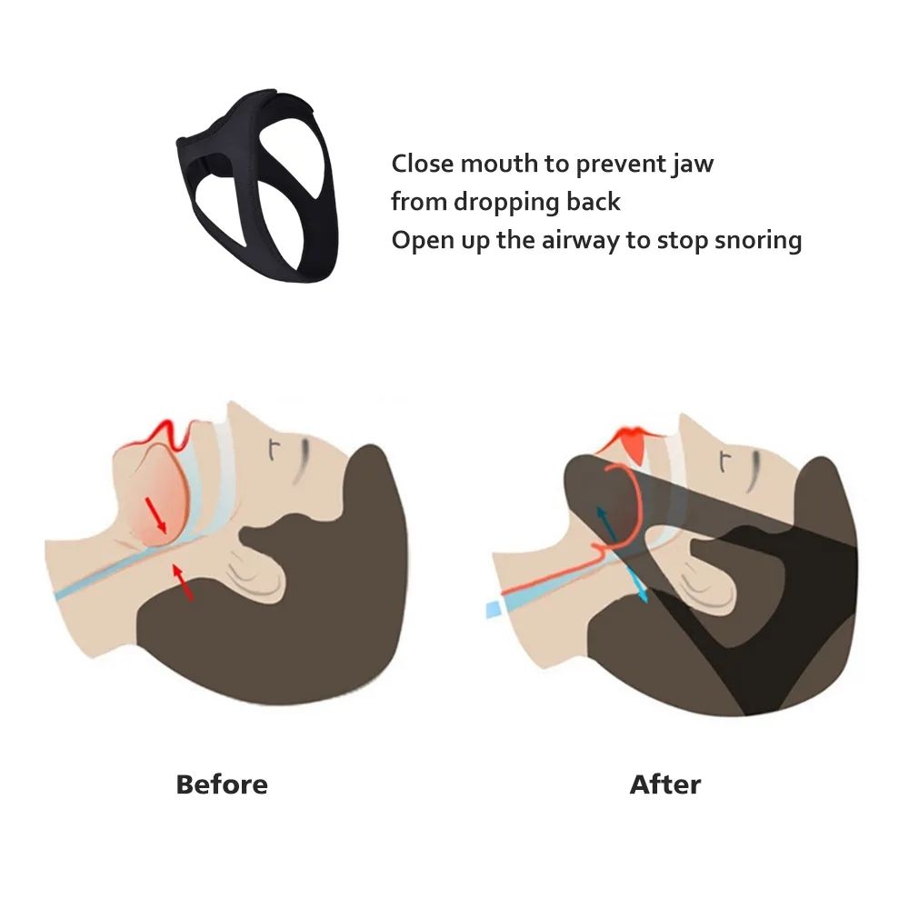 Adjustable Anti Snoring Chin Strap, Black, Stop Snoring Belt