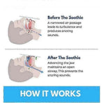 Honex Anti-Snoring Mouthpiece - Quite Night Device, PC+EVA
