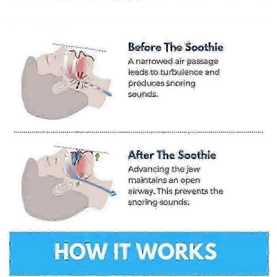 Honex Anti-Snoring Mouthpiece - Quite Night Device, PC+EVA