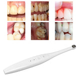 WiFi Oral Camera Smart HD 2 Million Pixels IP67 Waterproof Visual Dental Camera with LED Lights for Oral Inspection