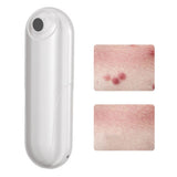 Bug Bite Itch Relief Tool USB Rechargeable Mosquito Bite Sucker Chemical Free for Bug Bites Bee Wasp Stings