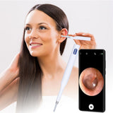 Wireless Otoscope 2.4Ghz Wireless 360 Degrees Wide Angle Lens 20fps CMOS Type C Charging Ear Scope for Home Hospital A - Extra Image