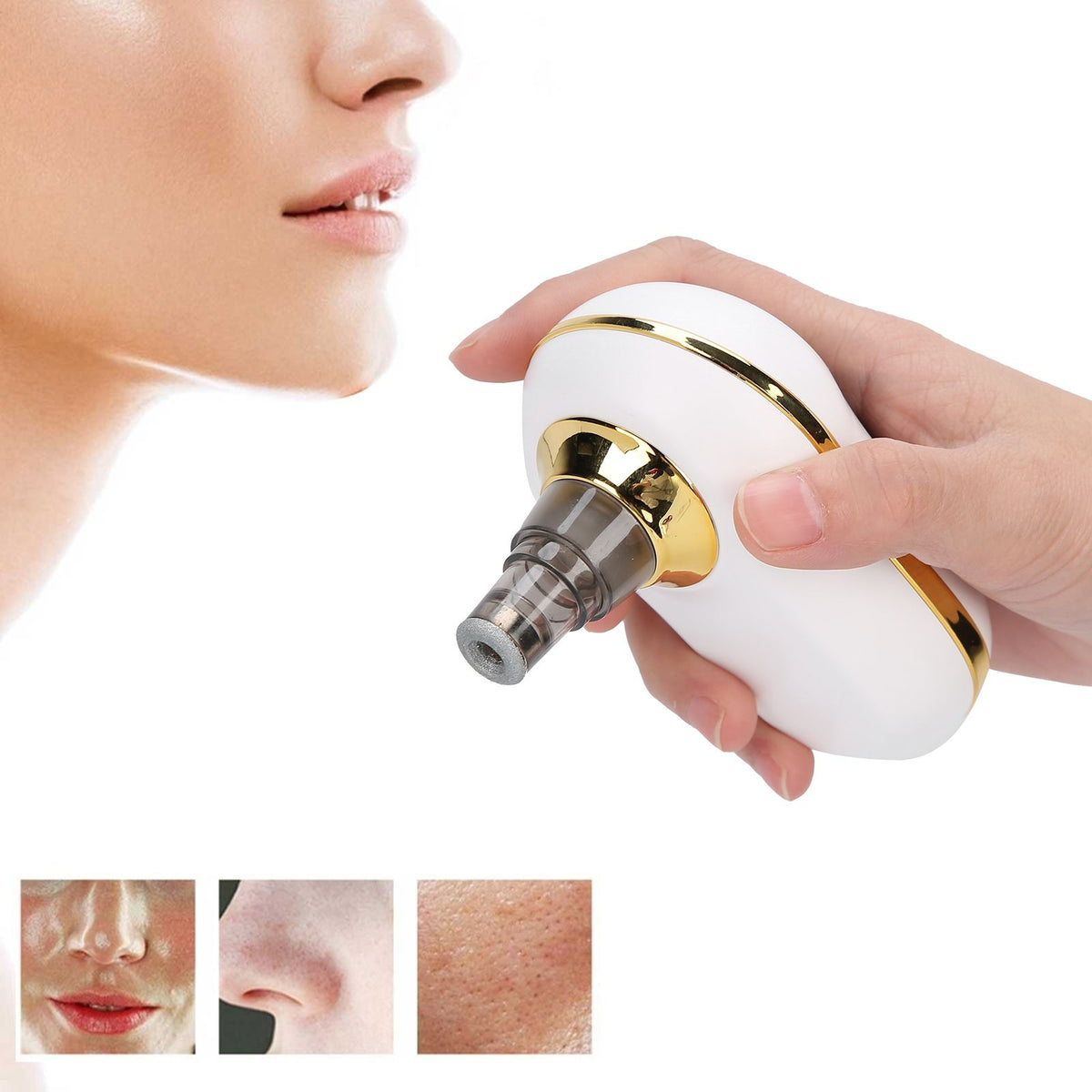 USB Charging Electric Blackhead Removal Machine Vacuum Suction Face Pore CleanerWhite