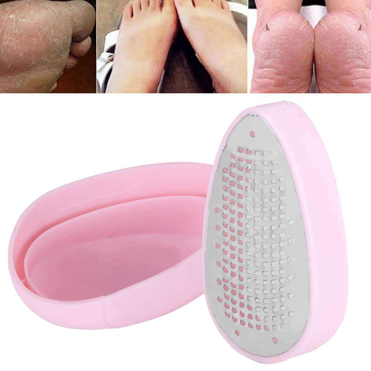 Manual Foot File Household Feet Callus Dead Skin Remover Tool Foot Care Accessory Pink