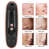 Blackhead Acnes Removal Machine Multifunction Visual Face Cleaner Device USB Charging - Extra Image