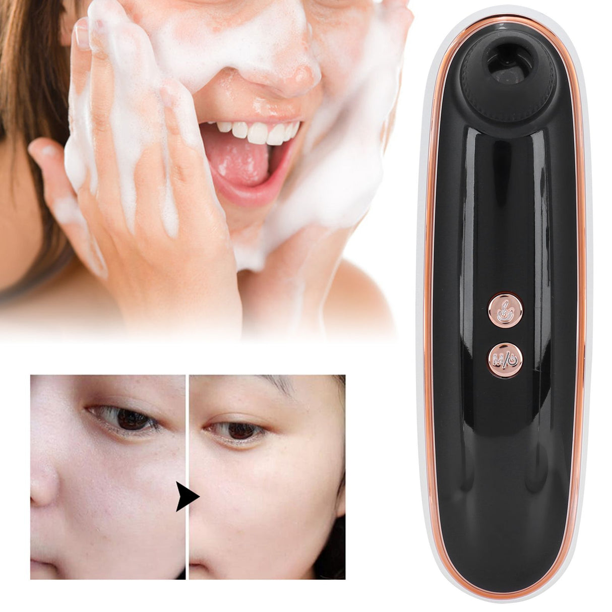 Blackhead Acnes Removal Machine Multifunction Visual Face Cleaner Device USB Charging