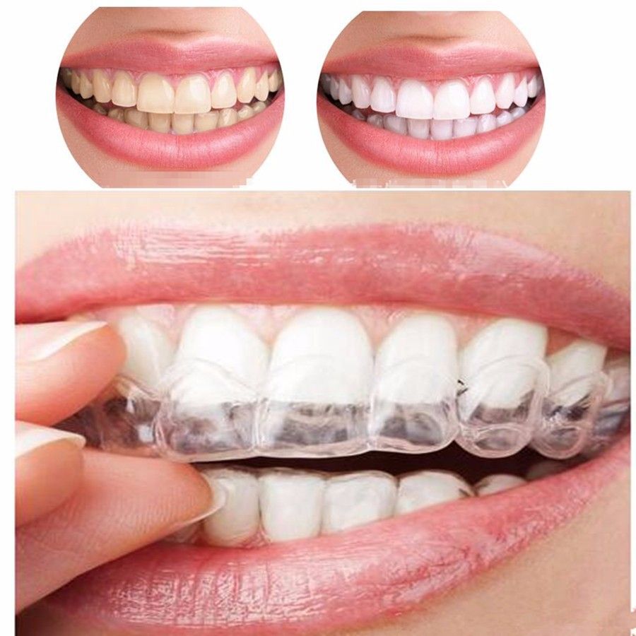 Retainer, Dental Retainer for Teeth, Retainers Nearly Invisible, Clear Retainer for Teeth, Clear Retainer, Teeth Retainer Kit