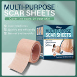 South moon Birthmark Skin Tone Concealer, Cover Body Scars Tattoo Spots Waterproof Color Masking Tape - Front View