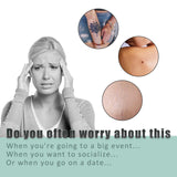 South moon Birthmark Skin Tone Concealer, Cover Body Scars Tattoo Spots Waterproof Color Masking Tape - 45-Degree Angle