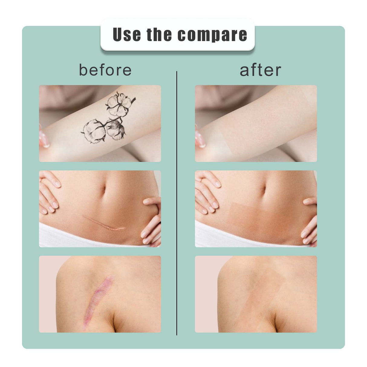 South moon Birthmark Skin Tone Concealer, Cover Body Scars Tattoo Spots Waterproof Color Masking Tape