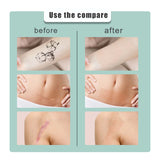 South moon Birthmark Skin Tone Concealer, Cover Body Scars Tattoo Spots Waterproof Color Masking Tape - Close-Up Angle