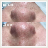 TOUCHBeauty Deep Cleansing Ultrasonic Skin Scrubber TB-1769 - Extra Image