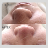 TOUCHBeauty Deep Cleansing Ultrasonic Skin Scrubber TB-1769 - Extra Image