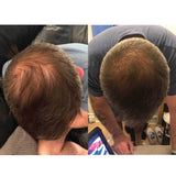 Watermans Grow Me Hair Growth Shampoo 250ml DHT Blocking Biotin Argan Anti Loss - Close-Up Angle