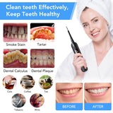 Electric Ultrasonic Dental Tartar Plaque Calculus Tooth Remover Set Kits Cleaner with LED Screen - Top-Down View