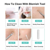Stainless Steel Blackhead Remover Tools Set with Pimple Extractors 4 Pieces - Black - Extra Image
