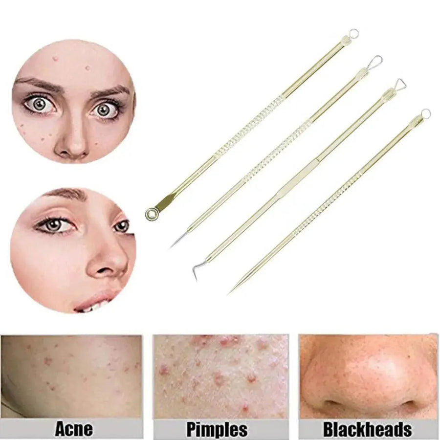 Stainless Steel Blackhead Remover Tools Set with Pimple Extractors 4 Pieces - Black