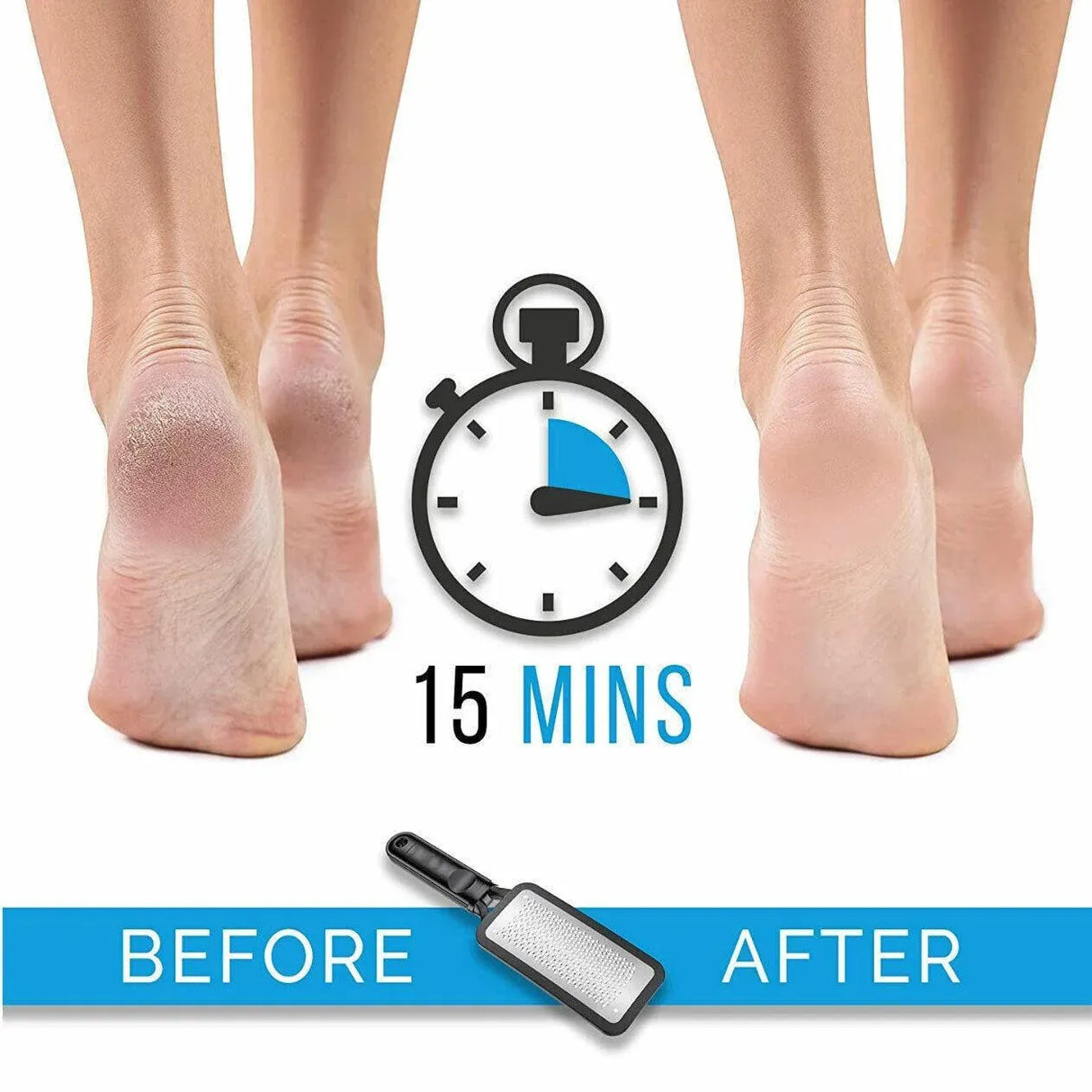 Stainless Steel Foot File Scraper Grater Pedicure Rasp Callus Remover Tool - Black