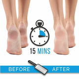 Stainless Steel Foot File Scraper Grater Pedicure Rasp Callus Remover Tool - Rose Red - Extra Image