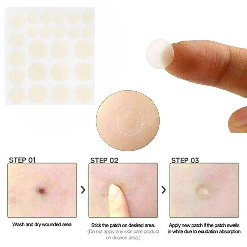 Cosrx Acne Pimple Master Patch 24 Patches Blemish Control Genuine New Sealed Au