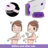 NNEOBA Painless Laser Touch Epilator Kit - Top-Down View