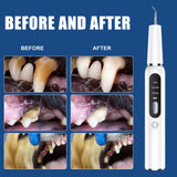 Black Professional Pet Dental Cleaning Kit - Ultrasonic Scaler, Tools & 3 Modes - Side View