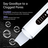 Rechargeable Ultrasonic Facial Spatula - Deep Pore Cleanser & Exfoliator - Side View