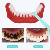 Intelligent High-Frequency Vibration Dental Calculus & Stain Remover(blue) - 45-Degree Angle