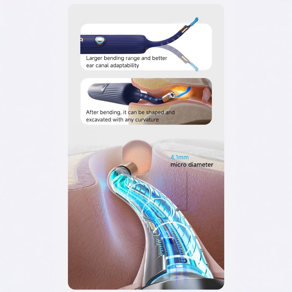 Smart Visual Ear Cleaner with HD Endoscope & Precision Tweezers - Safe for Adults & Children(white)