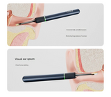 Smart Visual Ear Cleaner with HD Endoscope & Precision Tweezers - Safe for Adults & Children(white) - Top-Down View