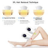 IPL Laser Hair Removal Device - 600,000 Flashes, 8 Intensity Levels, LCD Display & 2 Modes(white) - Side View
