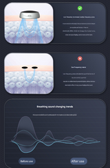 Black Smart Anti-Snoring Device - Rechargeable Pulse Throat Stimulator for Quieter Sleep - Top-Down View