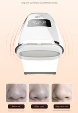 White Professional 4-in-1 Ultrasonic Skin Scrubber - Deep Pore Cleanser, Blackhead Remover & EMS Facial Lifting Tool - Top-Down View