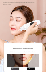 White Professional 4-in-1 Ultrasonic Skin Scrubber - Deep Pore Cleanser, Blackhead Remover & EMS Facial Lifting Tool - Low Angle