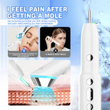 Advanced 3-in-1 Skin Care Device: 15-Level Spot Remover Pen with Hot & Cold Facial Therapy(White) - Top-Down View